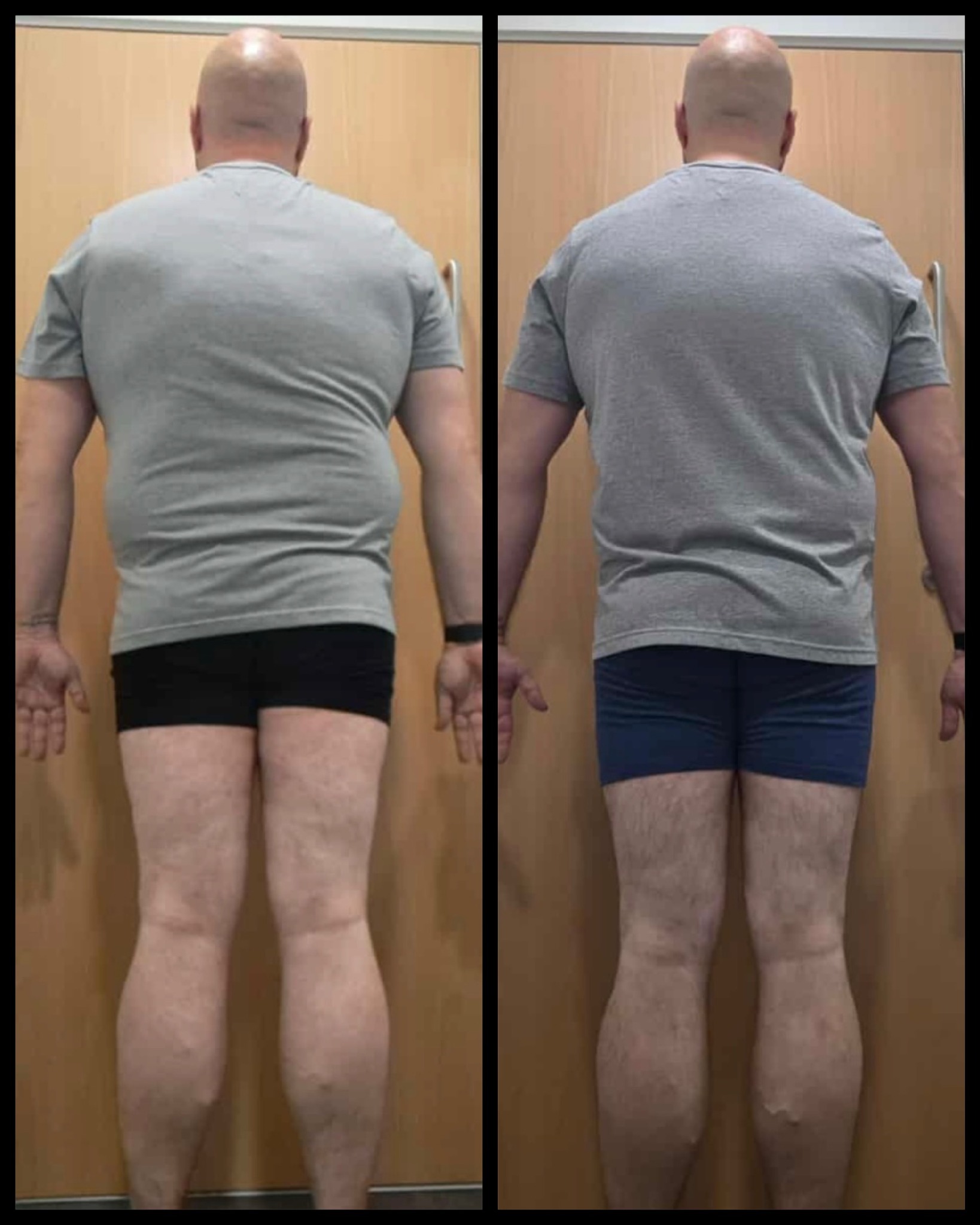RBT member front view transformation before and after